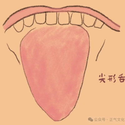 很多时候脾胃一直不好，往往是肝有问题（附上舌诊图）